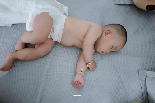 象山六个月宝宝眼睛散光